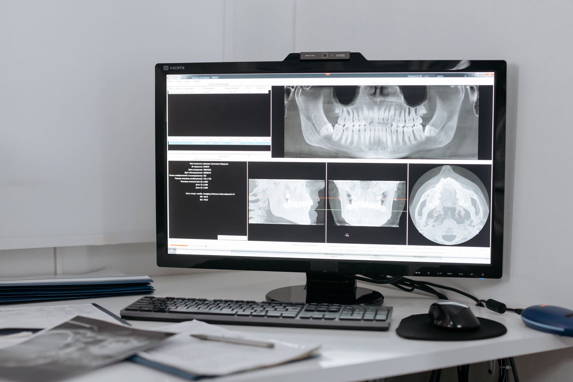 Why Conavi Medical Corp. stock is rising today