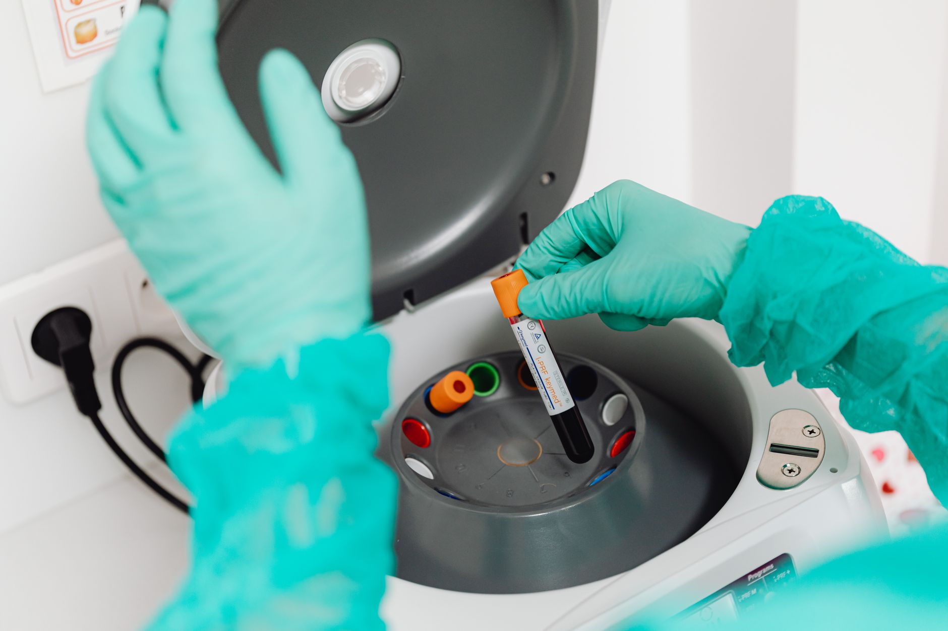 Why MedMira Inc stock surged yesterday